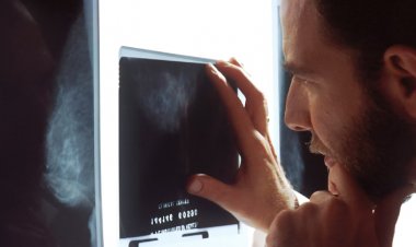 Prostat Kanseri Farkındalık Günü: Prostat Kanseri Belirtileri Nelerdir?