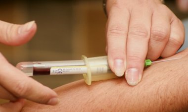 Kemik İliği Nakil Süreci Nasıldır, Nakil Nasıl Yapılır?