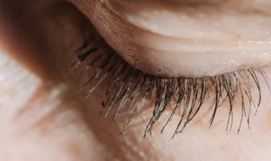 Göz Kapağındaki Yaralara Dikkat! Göz Kanseri İşareti Olabilir