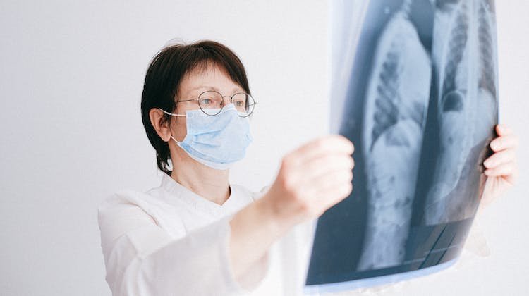 Akciğer Kanserinde Tedavi Yolları Nelerdir?